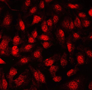 FLI1 Rabbit Polyclonal Antibody