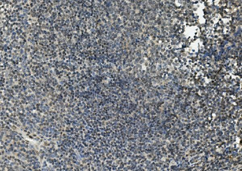 FLI1 Rabbit Polyclonal Antibody