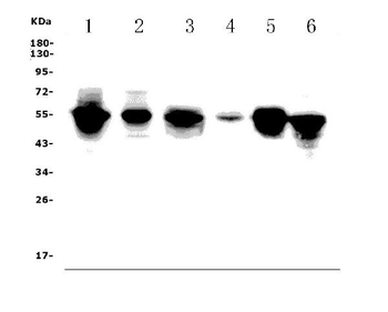 FLI1 Rabbit Polyclonal Antibody