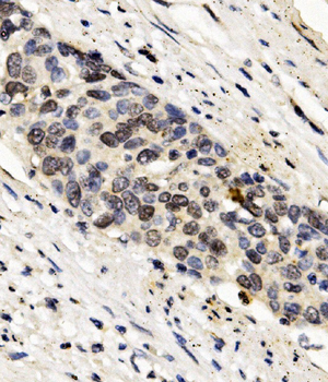 FOXF1 Rabbit Polyclonal Antibody