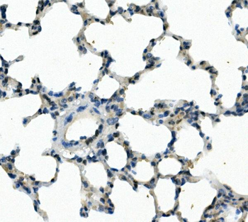 FOXF1 Rabbit Polyclonal Antibody