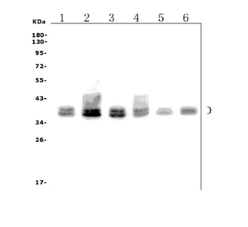 FOXF1 Rabbit Polyclonal Antibody