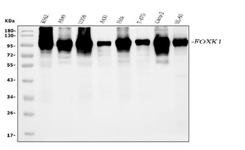 FOXK1/MNF Rabbit Polyclonal Antibody