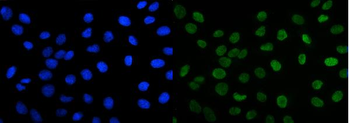 FOXK1/MNF Rabbit Polyclonal Antibody