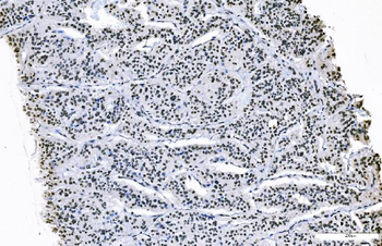 FOXK1/MNF Rabbit Polyclonal Antibody