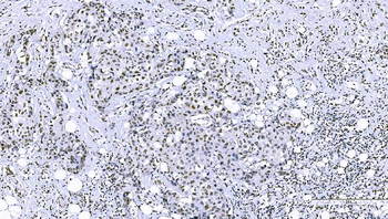 FOXK1/MNF Rabbit Polyclonal Antibody