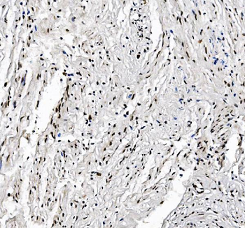 FOXK1/MNF Rabbit Polyclonal Antibody