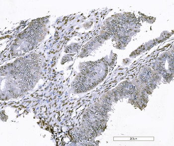 FOXK1/MNF Rabbit Polyclonal Antibody