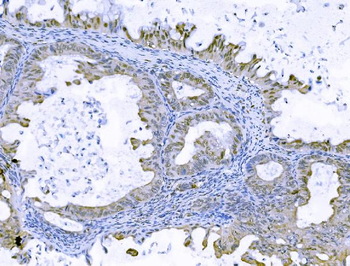 FOXK1/MNF Rabbit Polyclonal Antibody