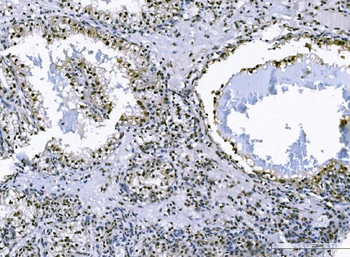 FOXK1/MNF Rabbit Polyclonal Antibody