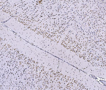 FOXK1/MNF Rabbit Polyclonal Antibody