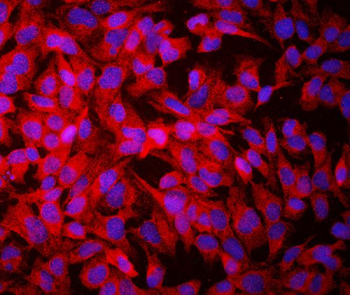 Growth hormone receptor/GHR Rabbit Polyclonal Antibody