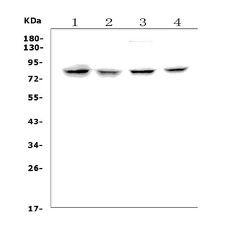 Growth hormone receptor/GHR Rabbit Polyclonal Antibody