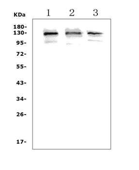 Growth hormone receptor/GHR Rabbit Polyclonal Antibody
