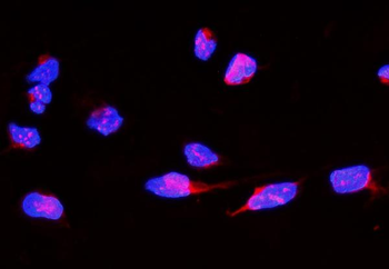 CD168/HMMR Rabbit Polyclonal Antibody