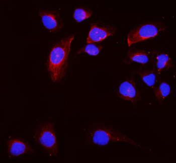CD168/HMMR Rabbit Polyclonal Antibody