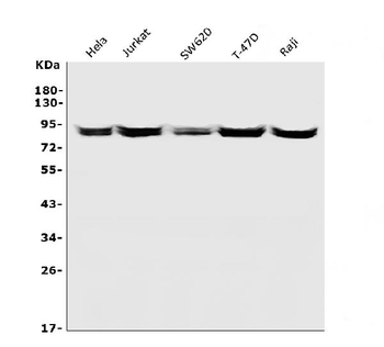 CD168/HMMR Rabbit Polyclonal Antibody