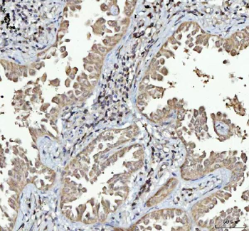 Menin/MEN1 Rabbit Polyclonal Antibody