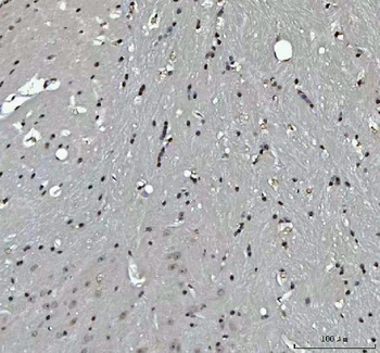 Menin/MEN1 Rabbit Polyclonal Antibody