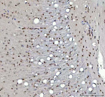 Menin/MEN1 Rabbit Polyclonal Antibody