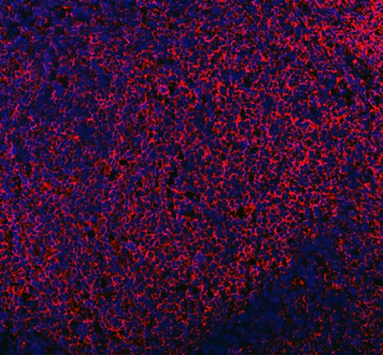 Mannose Receptor/MRC1 Rabbit Polyclonal Antibody