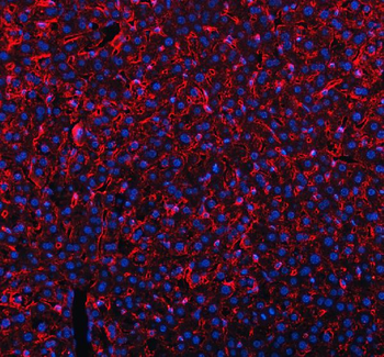 Mannose Receptor/MRC1 Rabbit Polyclonal Antibody