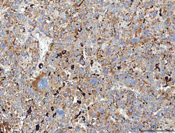 Mannose Receptor/MRC1 Rabbit Polyclonal Antibody