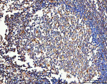 Mannose Receptor/MRC1 Rabbit Polyclonal Antibody