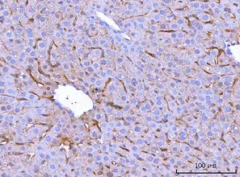 Mannose Receptor/MRC1 Rabbit Polyclonal Antibody