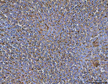Mannose Receptor/MRC1 Rabbit Polyclonal Antibody