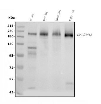 Mannose Receptor/MRC1 Rabbit Polyclonal Antibody