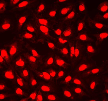 XLF/NHEJ1 Rabbit Polyclonal Antibody