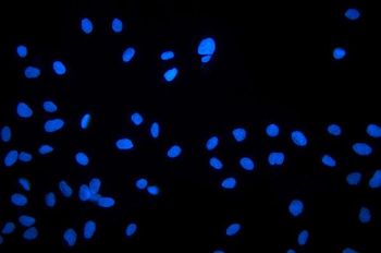 XLF/NHEJ1 Rabbit Polyclonal Antibody
