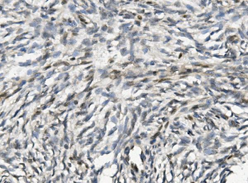 XLF/NHEJ1 Rabbit Polyclonal Antibody