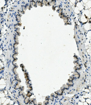 XLF/NHEJ1 Rabbit Polyclonal Antibody