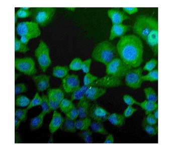 Niemann Pick C2/NPC2 Rabbit Polyclonal Antibody