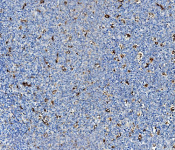 Niemann Pick C2/NPC2 Rabbit Polyclonal Antibody