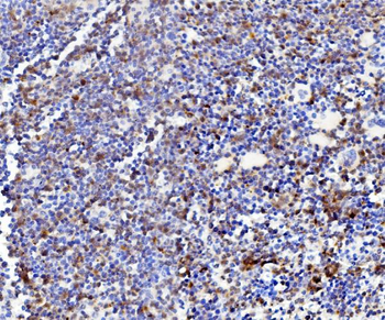 Niemann Pick C2/NPC2 Rabbit Polyclonal Antibody