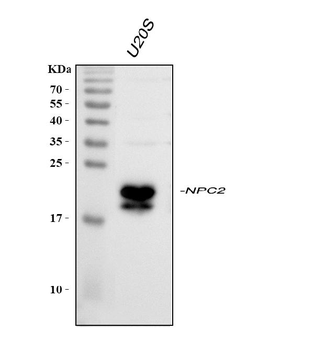 Niemann Pick C2/NPC2 Rabbit Polyclonal Antibody