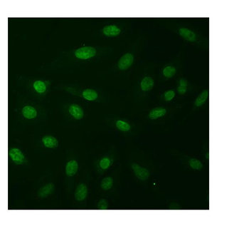 Natriuretic Peptide Receptor A/GC-A/NPR1 /GC Rabbit Polyclonal Antibody