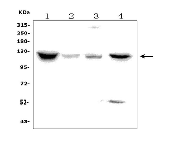 Natriuretic Peptide Receptor A/GC-A/NPR1 /GC Rabbit Polyclonal Antibody