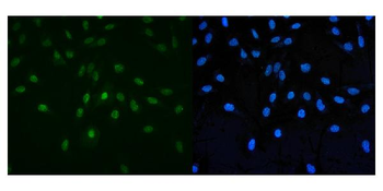 PAF1/PD2 Rabbit Polyclonal Antibody