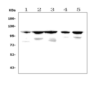 PGC1 beta/PPARGC1B Rabbit Polyclonal Antibody