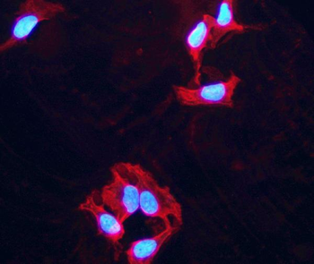 PPM1D/WIP1 Rabbit Polyclonal Antibody