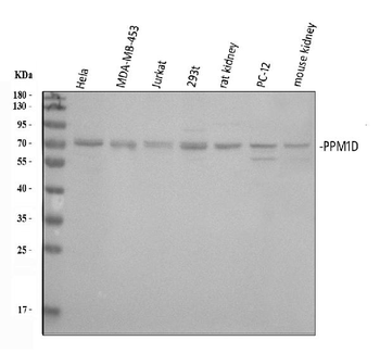 PPM1D/WIP1 Rabbit Polyclonal Antibody