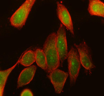 Rsk 2/MAPKAP Kinase 1b/RPS6KA3 Rabbit Polyclonal Antibody
