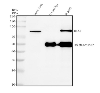 Rsk 2/MAPKAP Kinase 1b/RPS6KA3 Rabbit Polyclonal Antibody