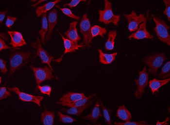 Slc25a1 Rabbit Polyclonal Antibody