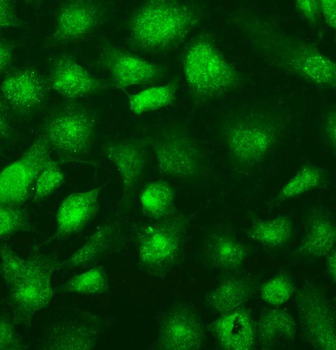 SUFU Rabbit Polyclonal Antibody