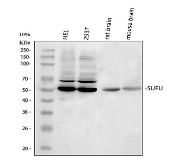 SUFU Rabbit Polyclonal Antibody